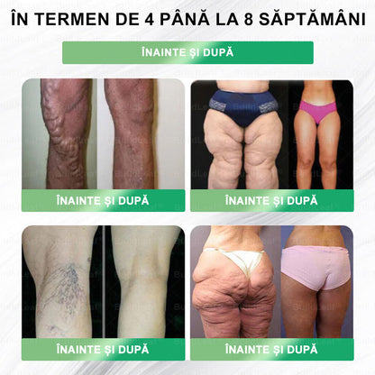 🎄🏆Au mai rămas doar 5 cutii! Profită acum de încă 50% reducere! Recapătă-ți silueta și sănătatea! Dacă ratezi această oportunitate acum, la anul s-ar putea să fie prea târziu! 💥🔥